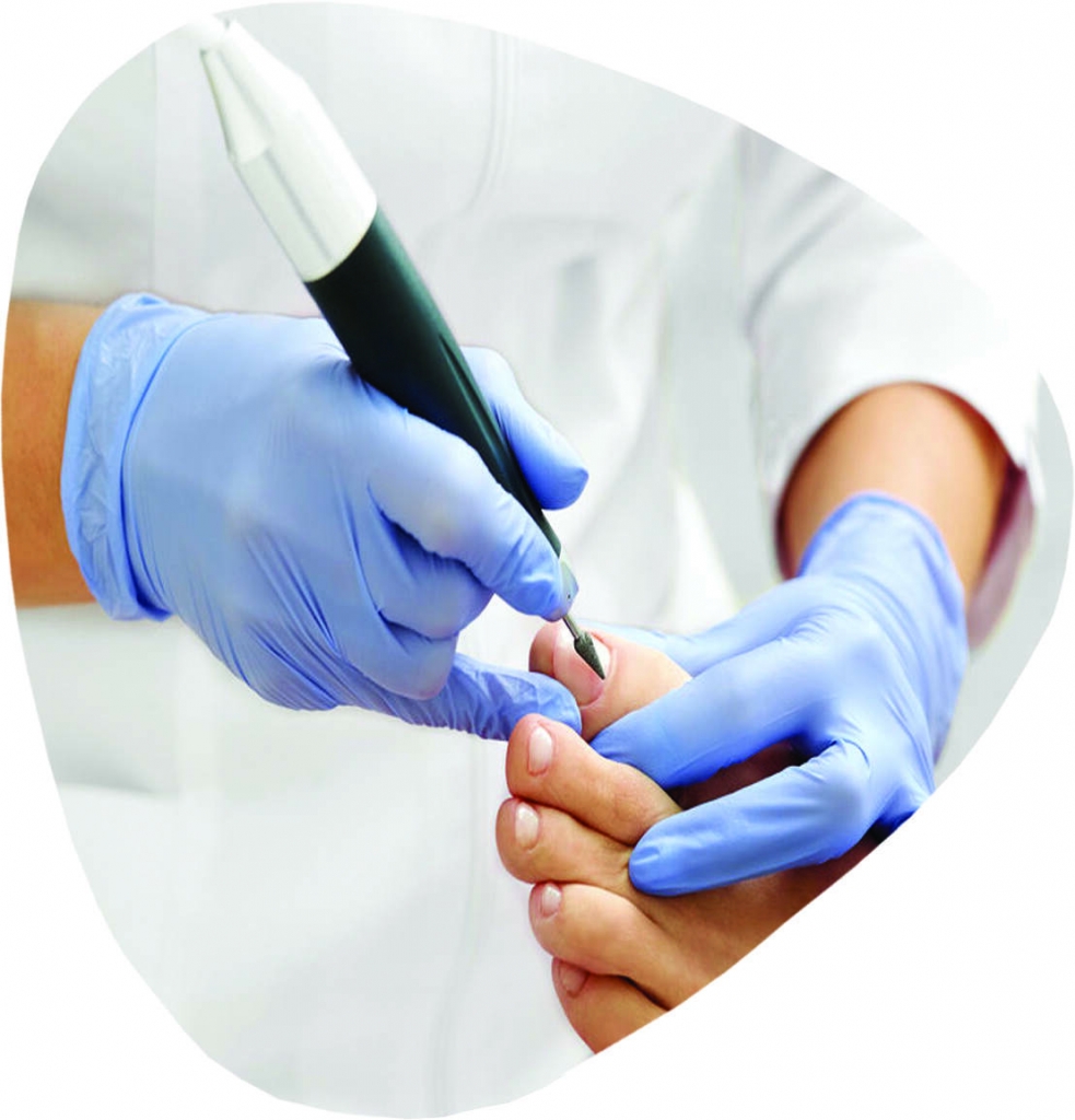 Fungal Nail Treatment services